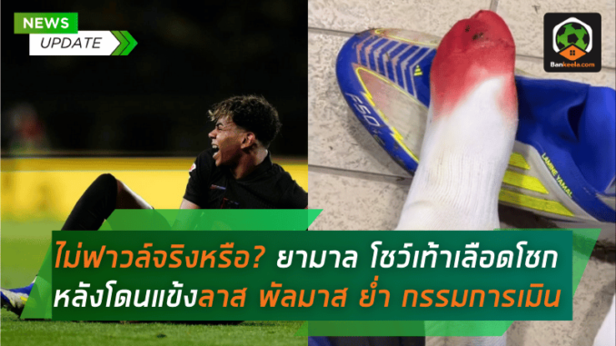 หลังโดนแข้งลาส